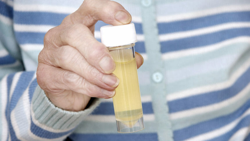 Elderly woman with a sterile universal container with a urine specimen tready for analysis
