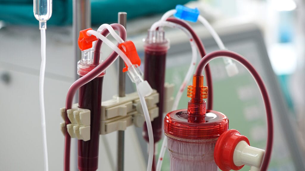 Outset Medical, US Renal Care partner to expand home dialysis opportunities